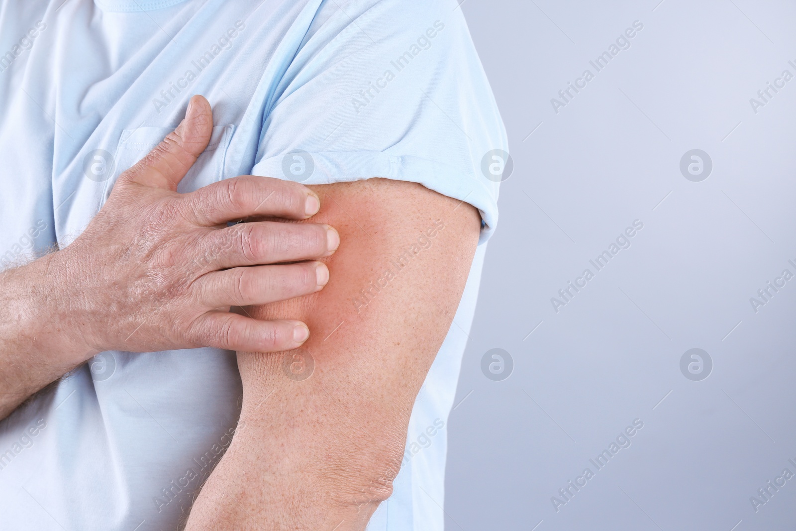 Photo of Senior man scratching arm on grey background, closeup with space for text. Allergy symptom