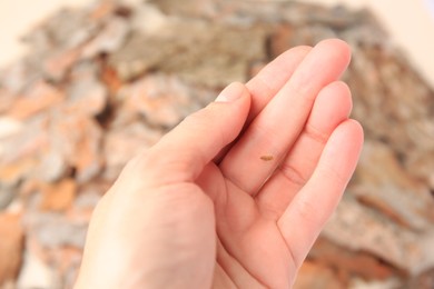 Woman with splinter in her finger on blurred background, closeup