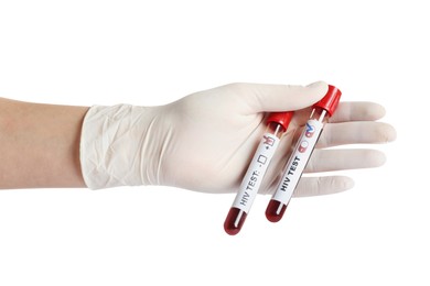 Photo of Scientist holding tubes with blood samples and labels HIV Test on white background, closeup