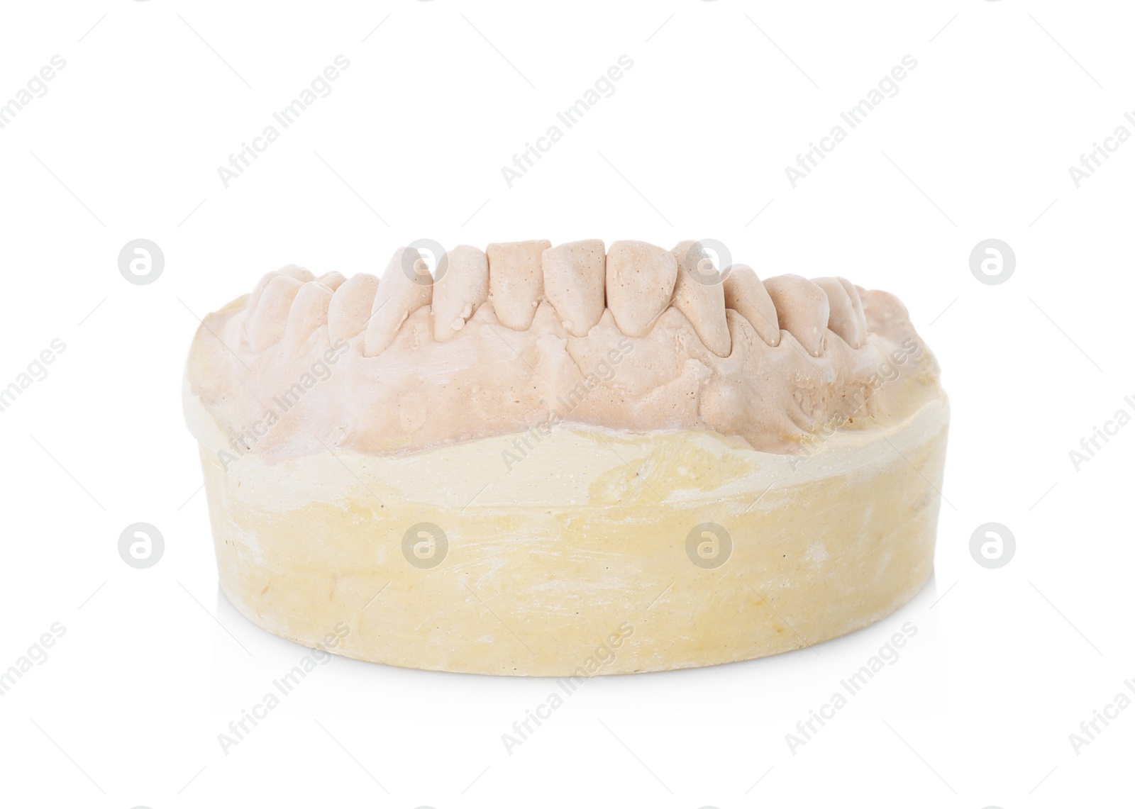 Photo of Dental model with jaw isolated on white. Cast of teeth