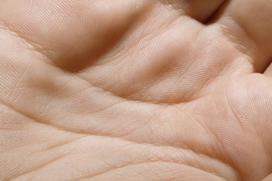 Closeup view of human hand with dry skin