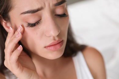 Photo of Young woman with eyelash loss problem, closeup