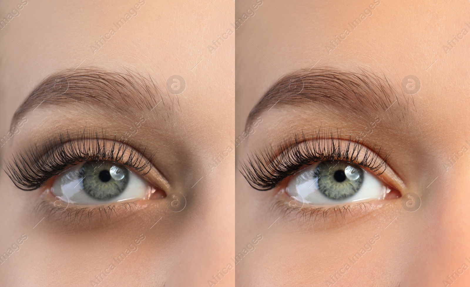 Image of Collage with photos of tired woman with dark circle under eye and after rest, closeup