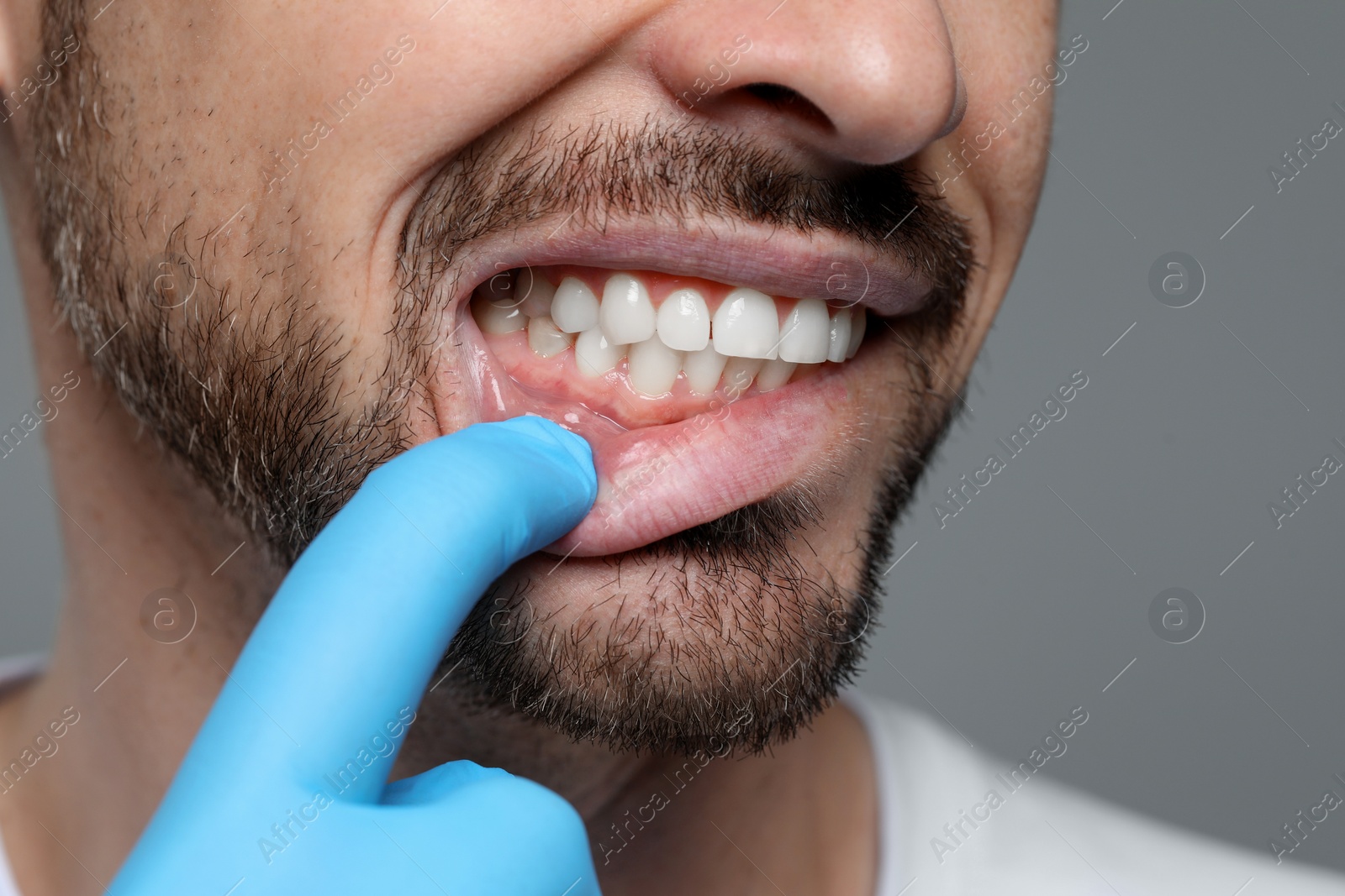 Photo of Man showing healthy gums on gray background, closeup