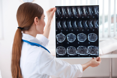 Photo of Professional orthopedist examining X-ray picture in her office