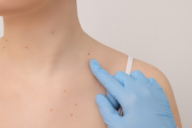 Photo of Dermatologist examining patient's birthmark on beige background, closeup