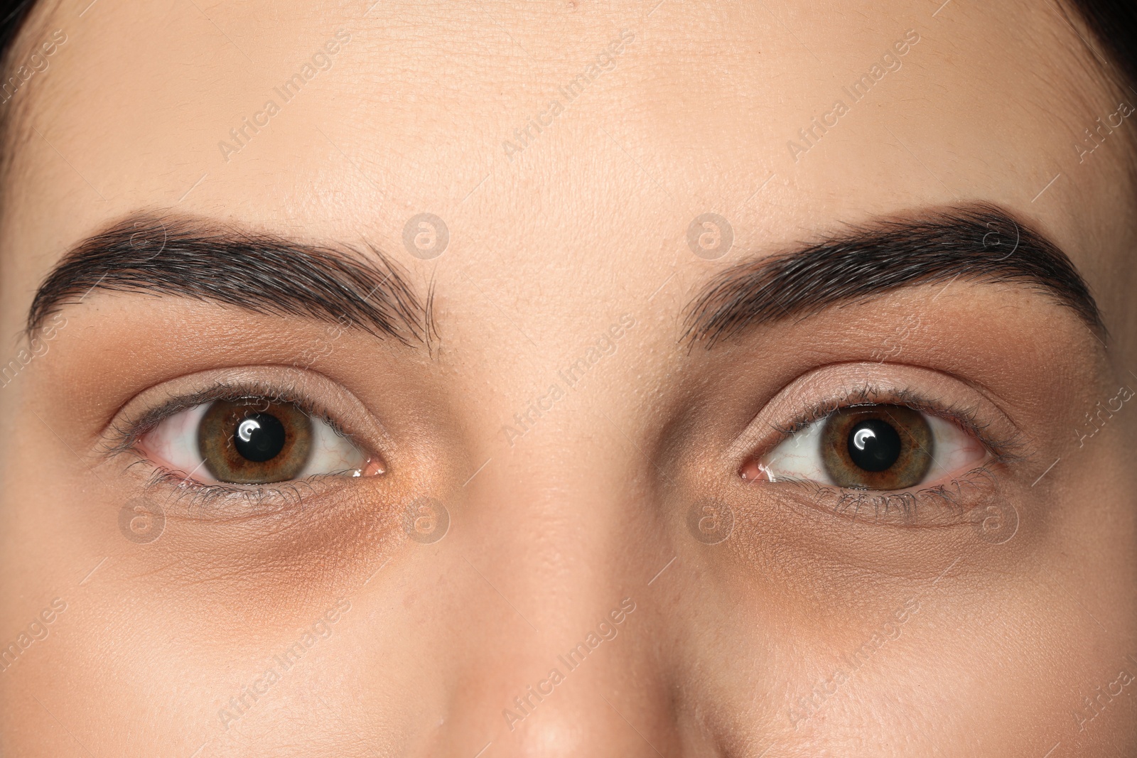 Image of Tired young woman with dark circles under eyes, closeup