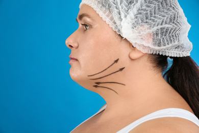 Photo of Woman with double chin ready for cosmetic surgery operation on blue background