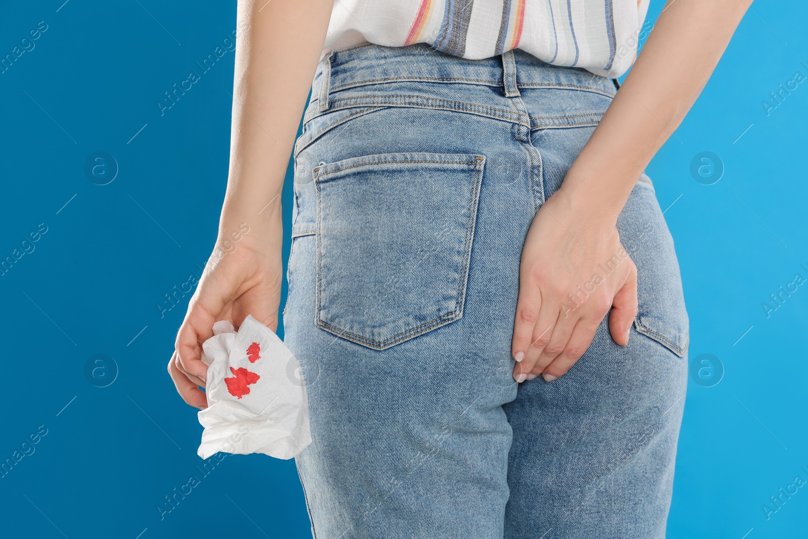 Photo of Woman holding toilet paper with blood stain on light blue background, closeup. Hemorrhoid concept
