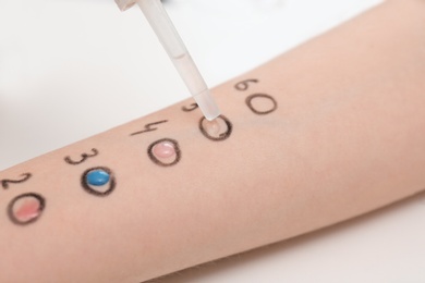 Patient undergoing skin allergy test at light table, closeup