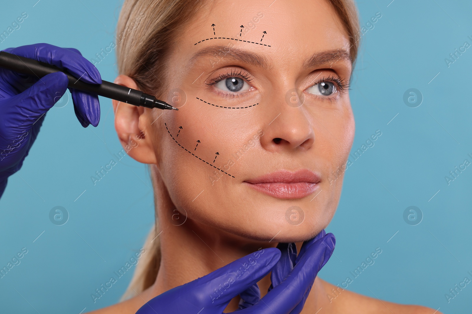 Image of Woman preparing for cosmetic surgery, light blue background. Doctor drawing markings on her face, closeup