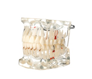 Photo of Artificial jaw model with teeth for education on white background. Medical item