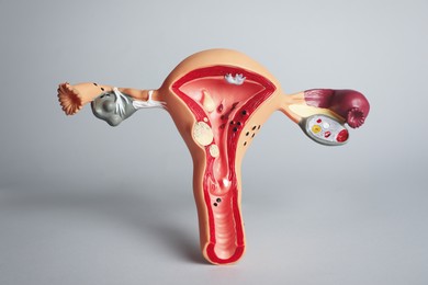 Model of female reproductive system on grey background. Gynecological care