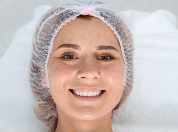 Photo of Woman after face biorevitalization procedure in salon. Cosmetic treatment