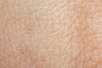 Photo of Texture of healthy skin as background, macro view