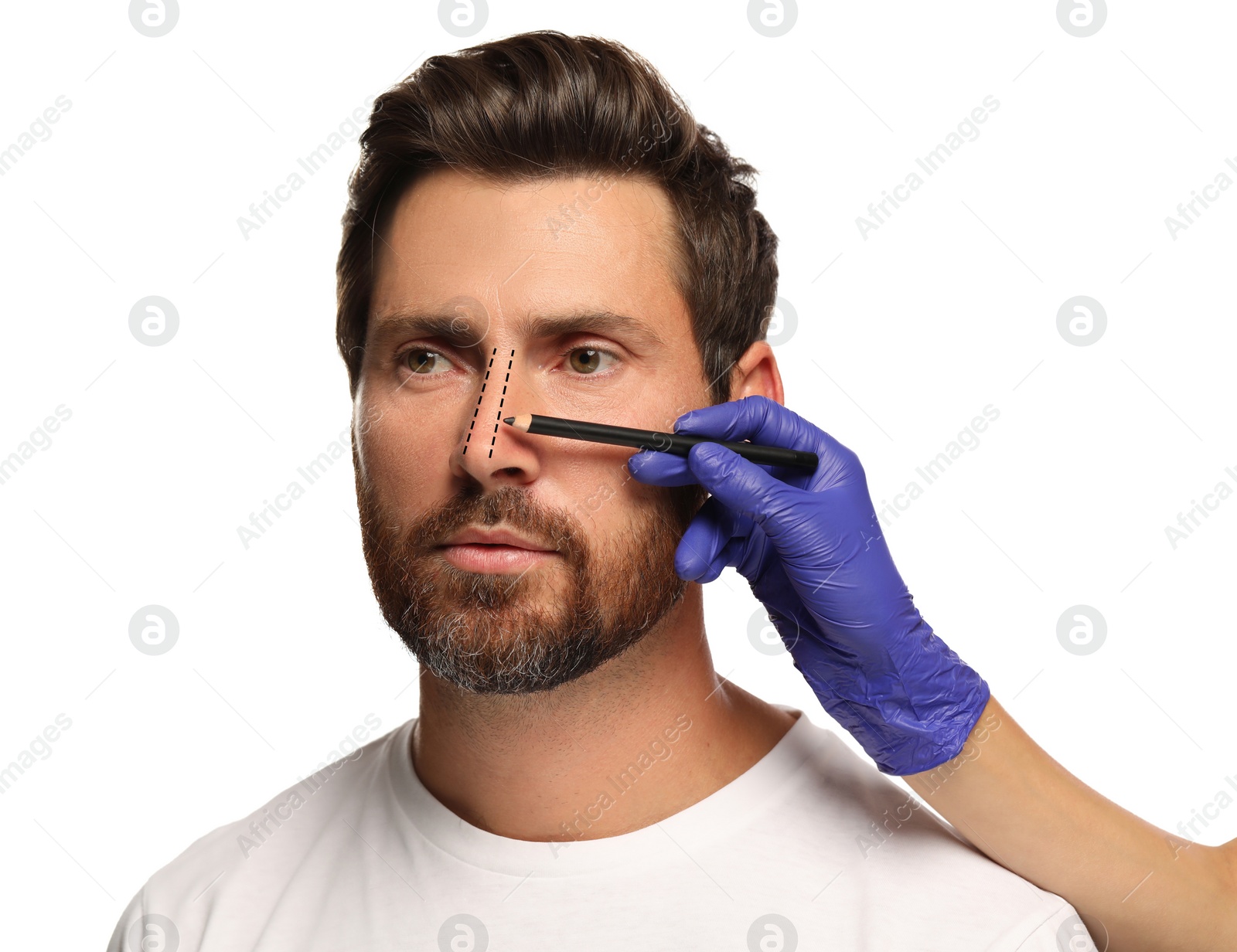 Image of Man preparing for cosmetic surgery, white background. Doctor drawing markings on his face, closeup