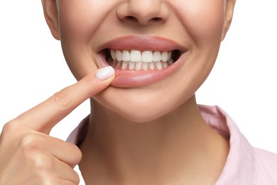 Woman showing her clean teeth on white background, closeup