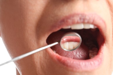 Examining patient's gums on white background, closeup view