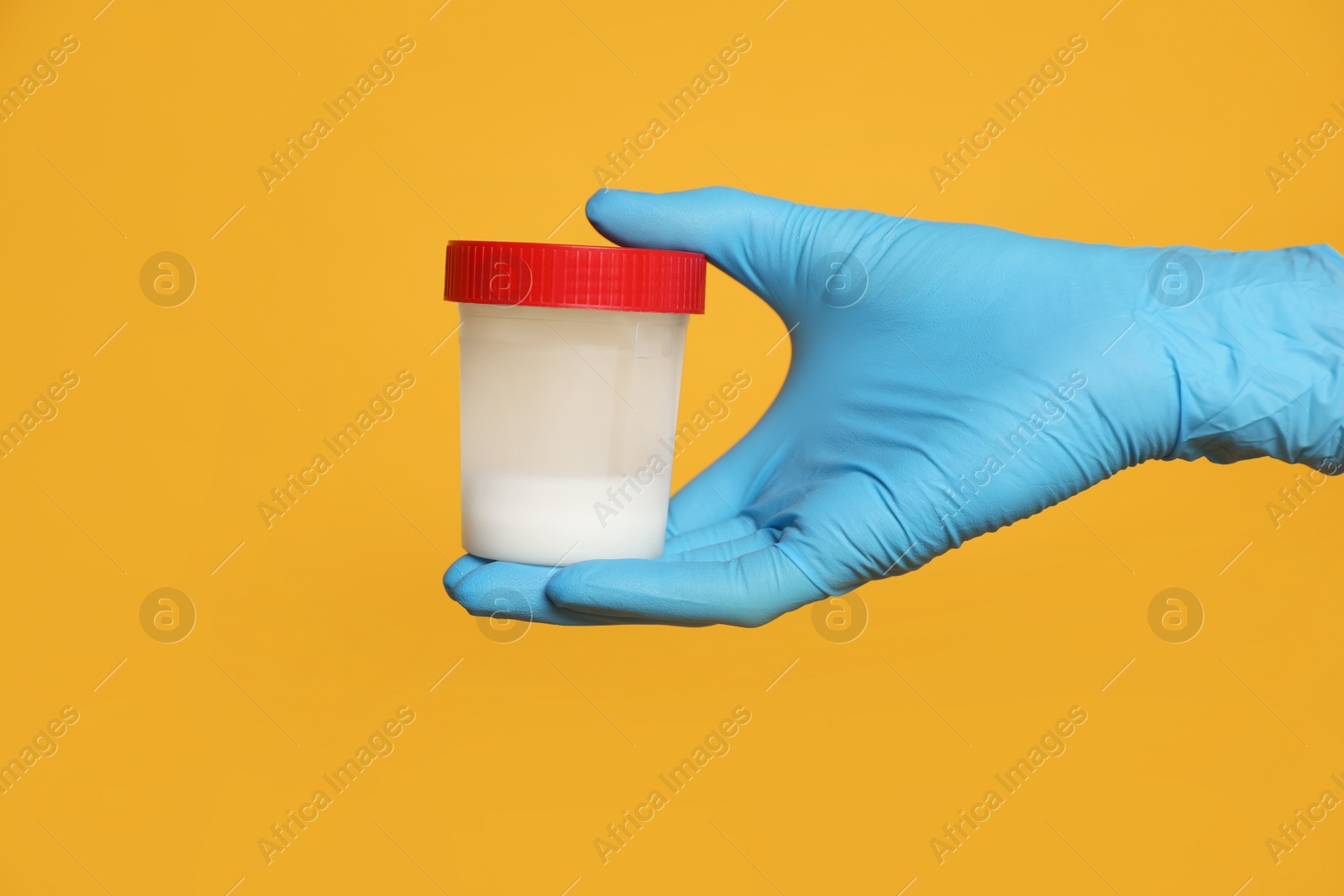 Photo of Scientist holding container with sperm on yellow background, closeup