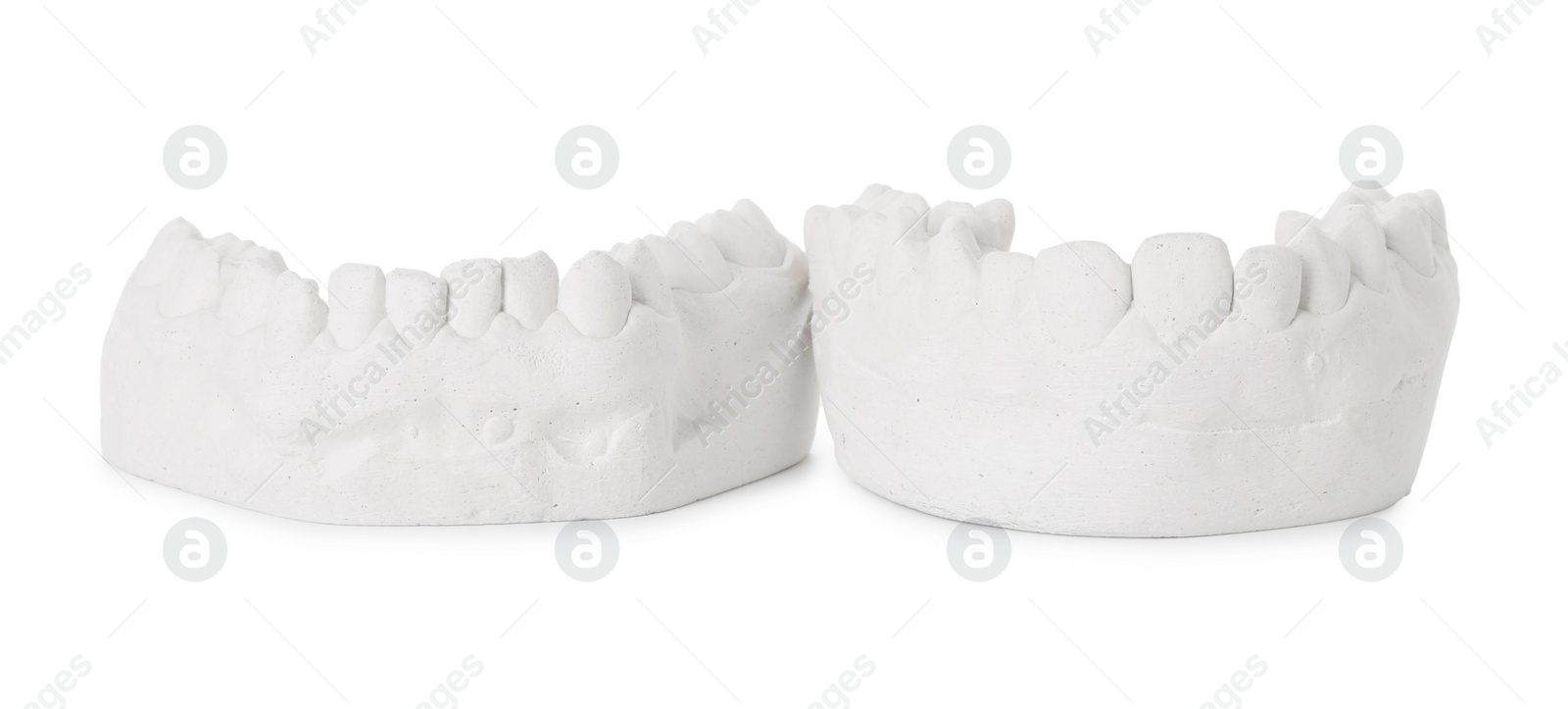 Photo of Dental model with gums isolated on white. Cast of teeth