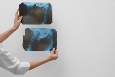 Photo of Doctor examining neck MRI images on light grey background, closeup. Space for text