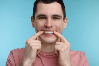 Young man applying whitening strip on his teeth against light blue background
