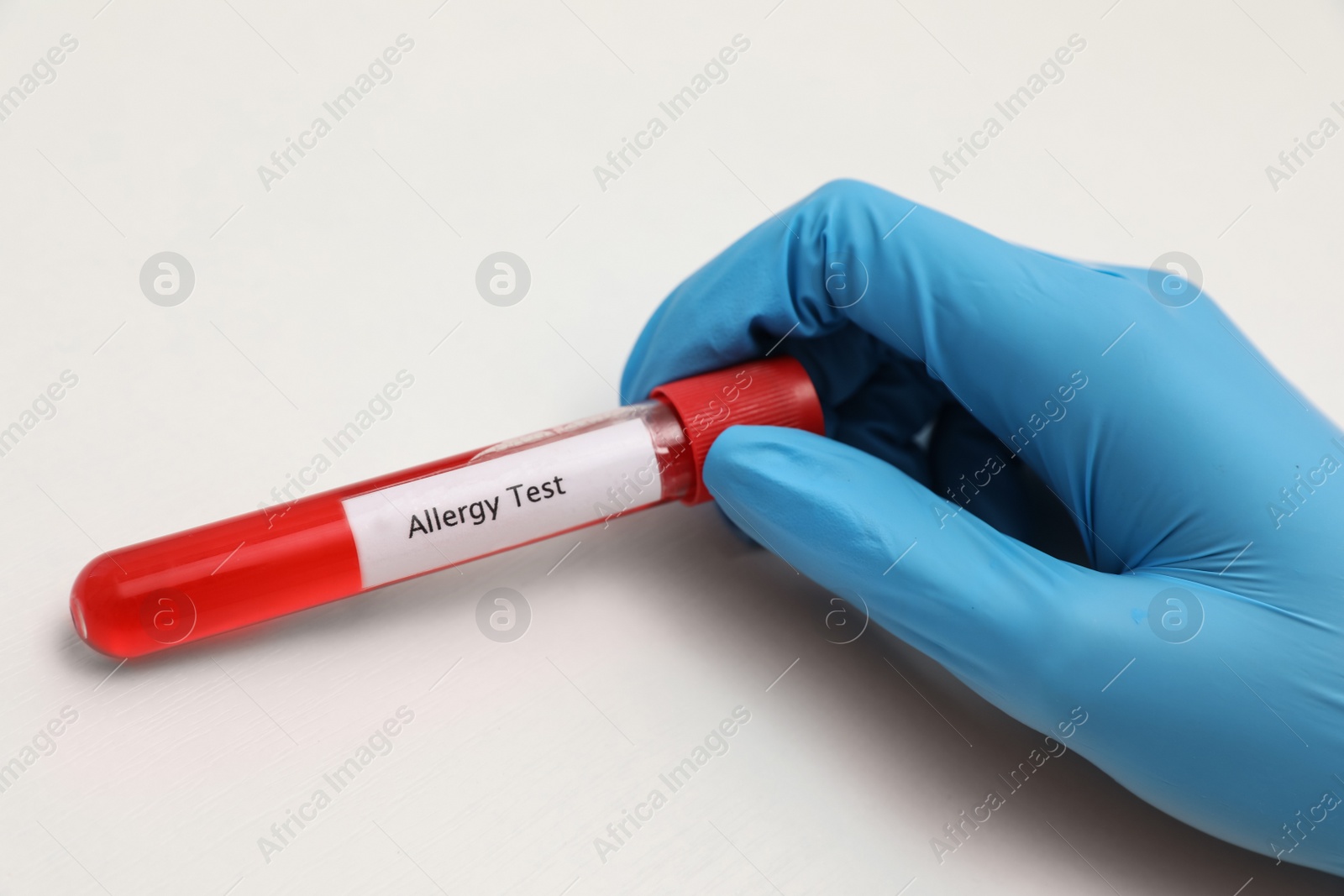 Photo of Doctor holding tube with label ALLERGY TEST on light background, closeup