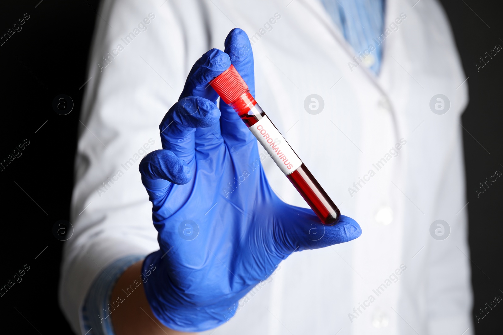 Photo of Scientist holding test tube with blood sample and label CORONA VIRUS on black background, closeup