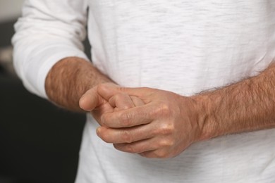 Man cracking his knuckles on blurred background, closeup. Bad habit