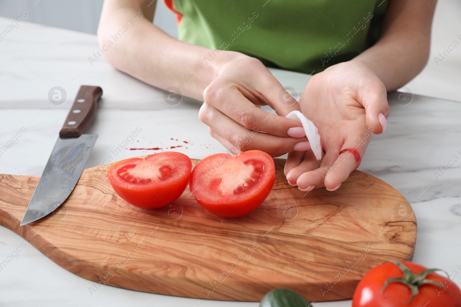 Photo of Young woman wiping cut finger with cotton pad in kitchen, closeup