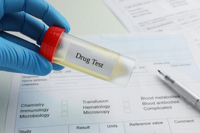 Photo of Drug test. Laboratory worker holding container with urine sample over medical form on table, closeup