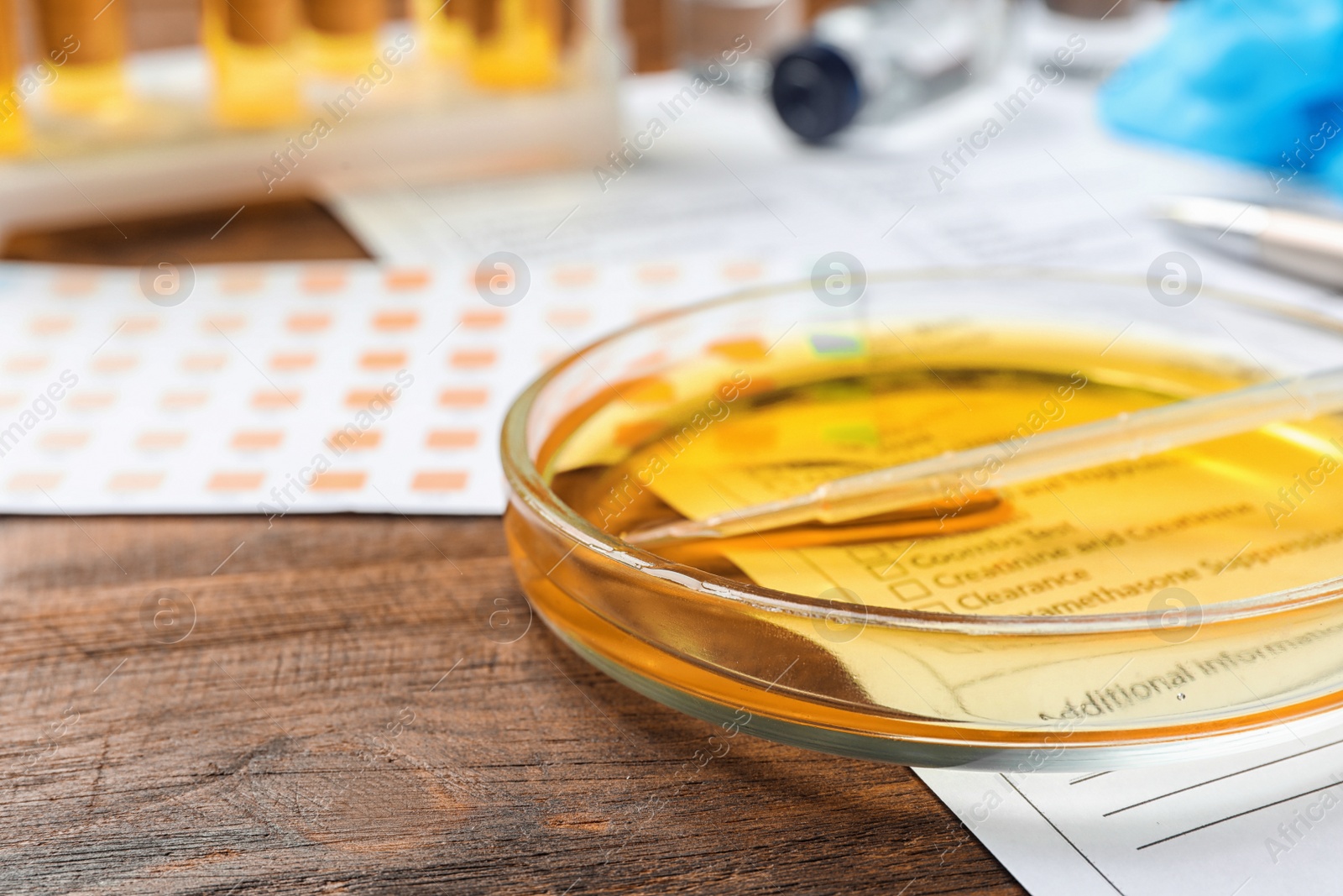 Photo of Glass dish with urine sample on table. Urology concept