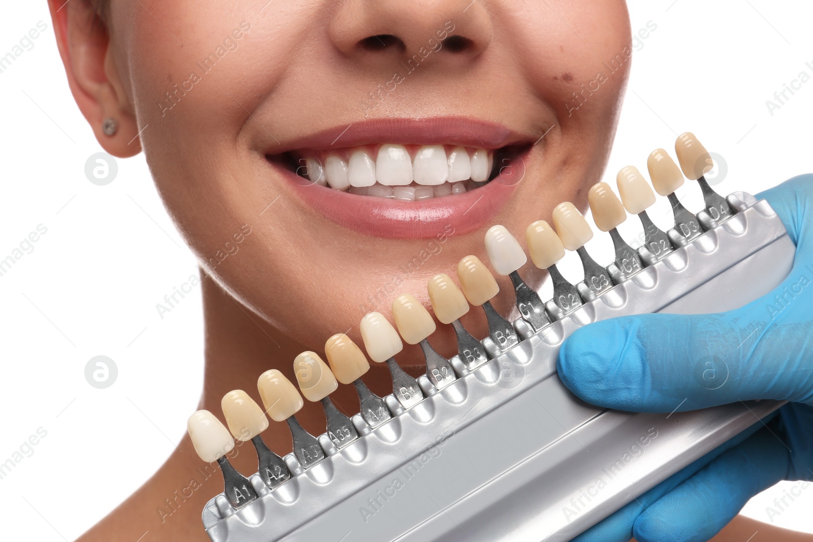 Photo of Doctor checking young woman's teeth color on white background, closeup. Cosmetic dentistry