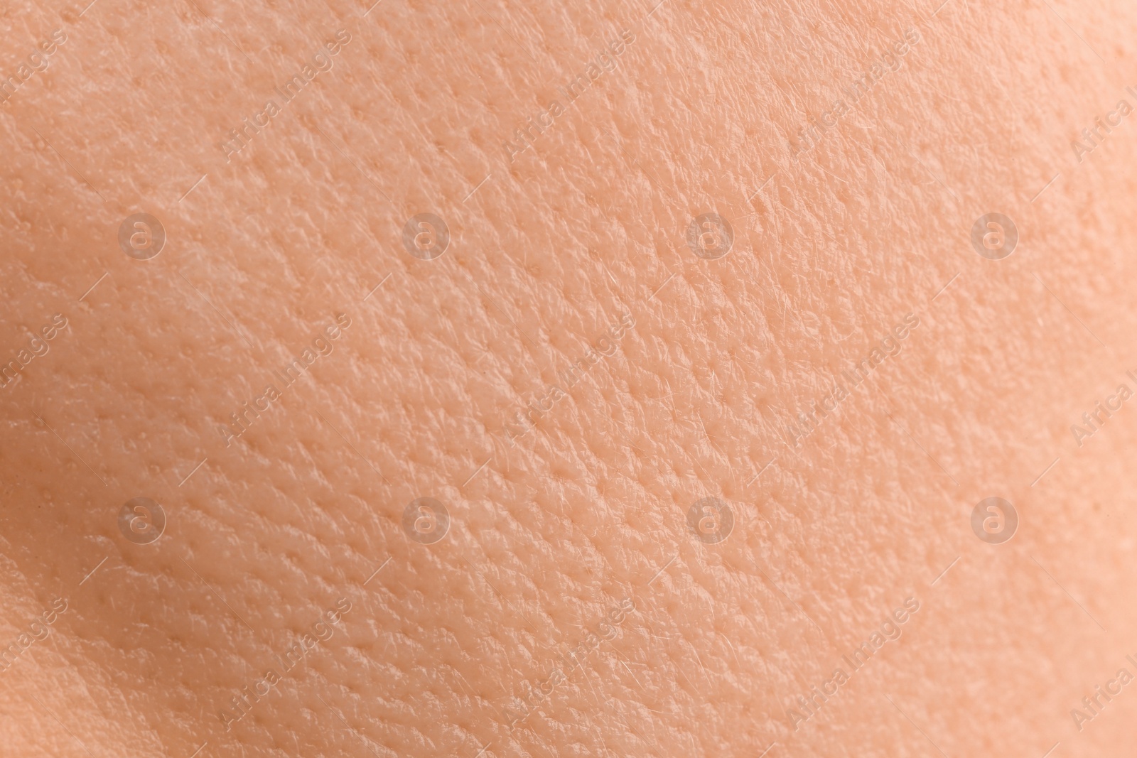 Photo of Texture of dry skin as background, macro view