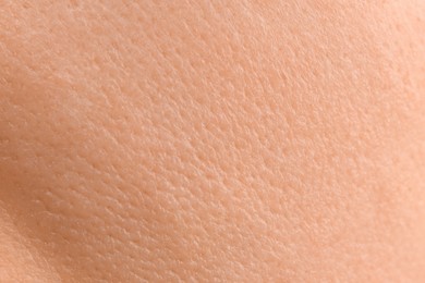 Photo of Texture of dry skin as background, macro view