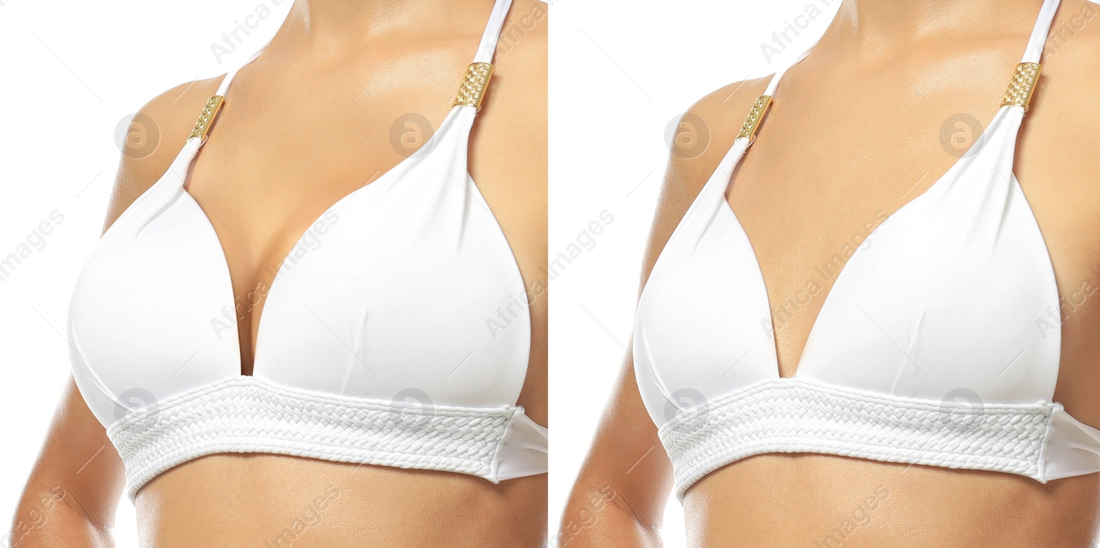 Image of Collage with photos of young woman before and after breast size correction on white background, closeup. Banner design