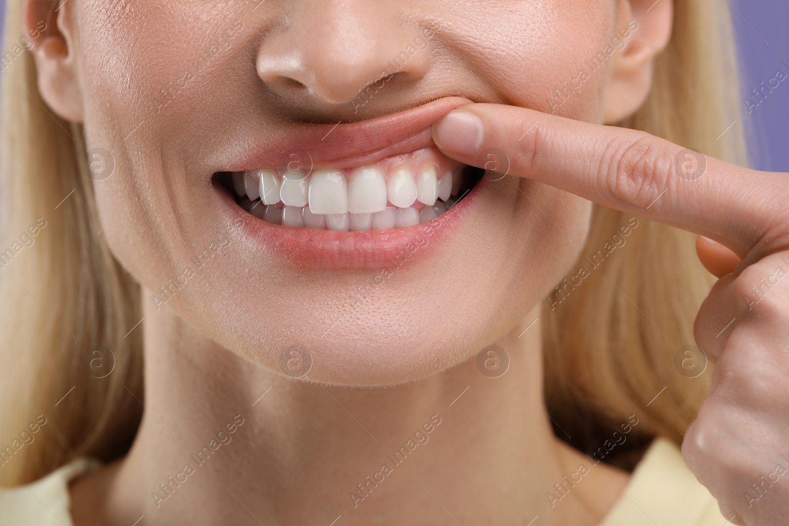 Photo of Woman showing her clean teeth, closeup view