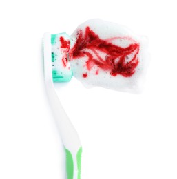 Photo of Toothbrush with paste and blood on white background, top view. Gum inflammation