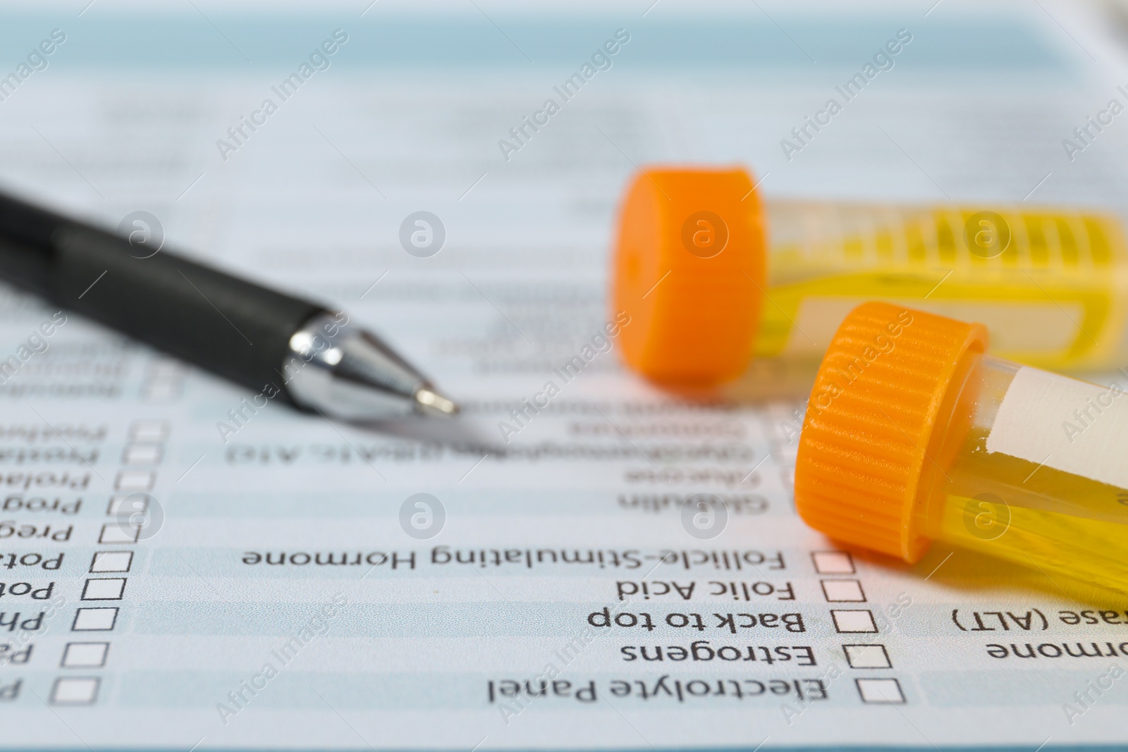 Photo of Containers with urine samples for analysis on medical report, closeup. Laboratory tests