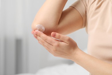 Young woman with dry skin applying cream onto her elbow indoors, closeup