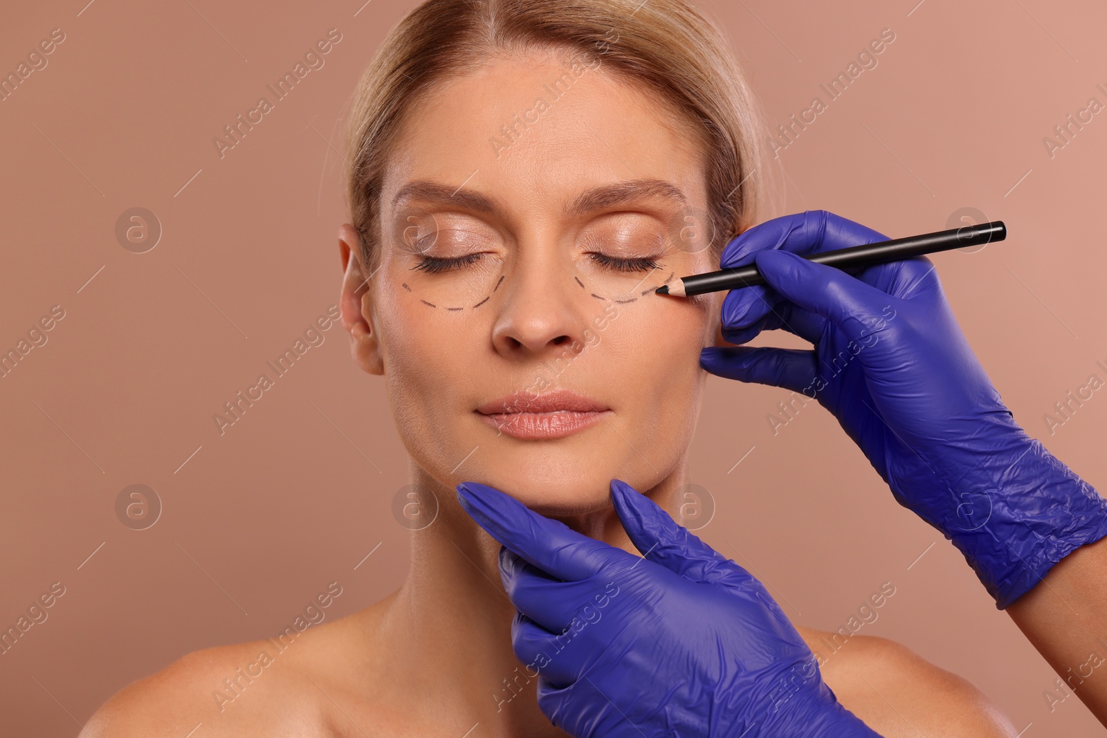 Photo of Doctor with pencil preparing patient for cosmetic surgery operation on light brown background, closeup