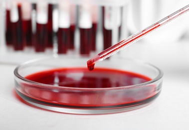 Photo of Pipetting blood into Petri dish for analysis on table in laboratory, closeup