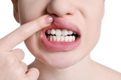 Young woman showing healthy gums on white background, closeup