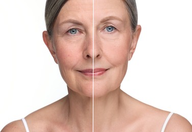 Aging skin changes. Collage with photos of mature woman before and after cosmetic procedure on white background
