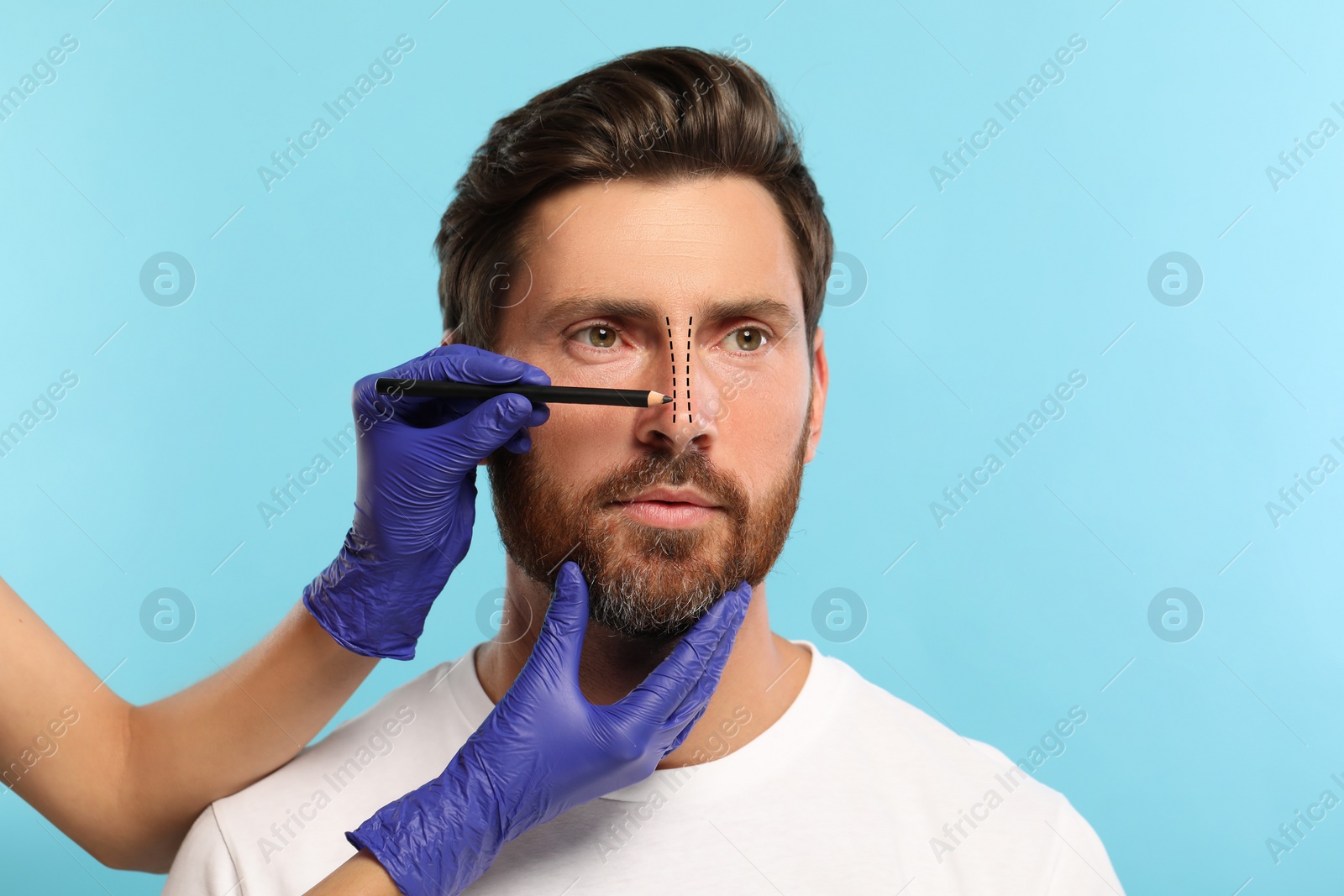 Image of Man preparing for cosmetic surgery, light blue background. Doctor drawing markings on his face, closeup