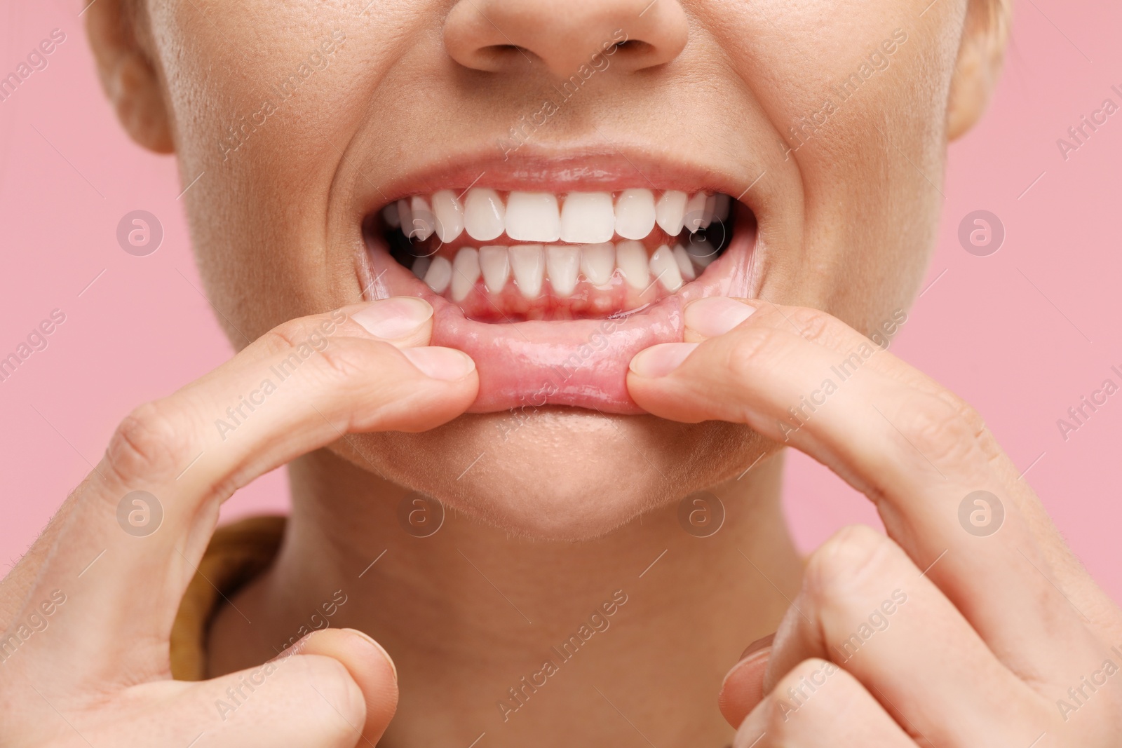 Photo of Woman showing her clean teeth on pink background, closeup