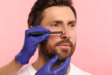 Man preparing for cosmetic surgery, pink background. Doctor drawing markings on his face, closeup