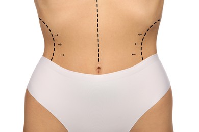 Woman with markings for cosmetic surgery on her abdomen against white background, closeup