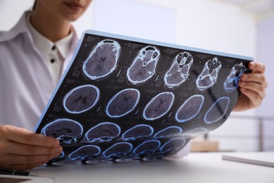 Doctor examining MRI images of patient with multiple sclerosis at table in clinic, closeup
