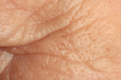 Photo of Texture of human skin with wrinkles as background, macro view